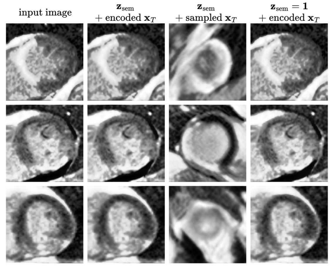 Visual comparison of reconstructions using an extensively trained diffusion autoencoder model for the Emidec dataset, and applying the various methods of encoding an input image.